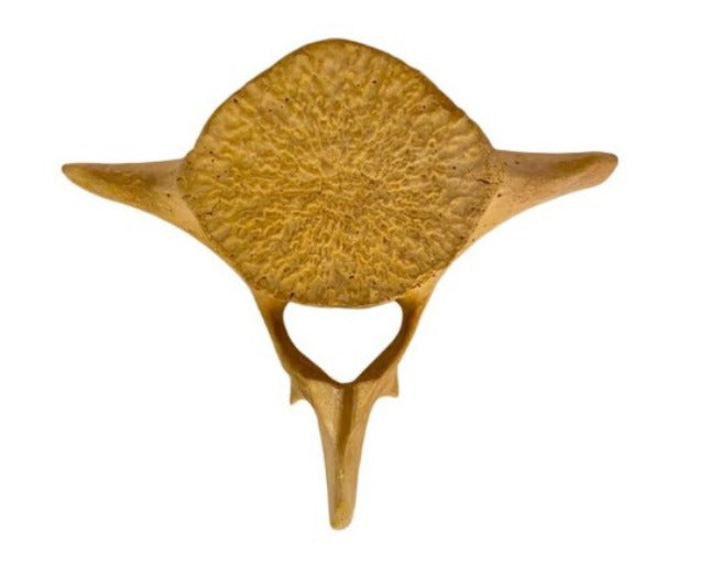 Whale Vertebrae